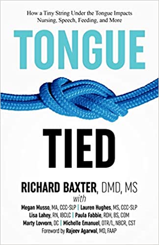 Tongue Tied (Used Paperback)-Richard Baxter, DMD,MS