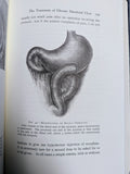 Duodenal Ulcer (Used Hardcover) - Berkeley Moynihan Baron Moynihan (1991)